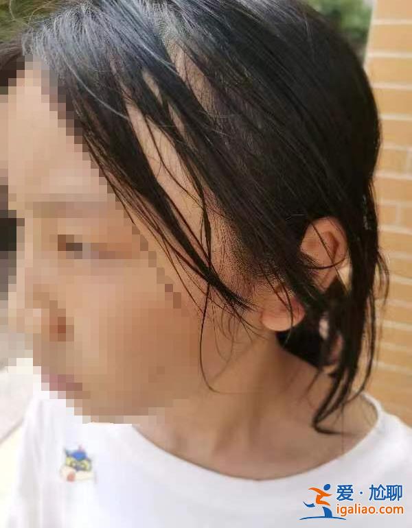 13歲女孩被老師扇致耳膜穿孔！學(xué)?；貞?yīng)？