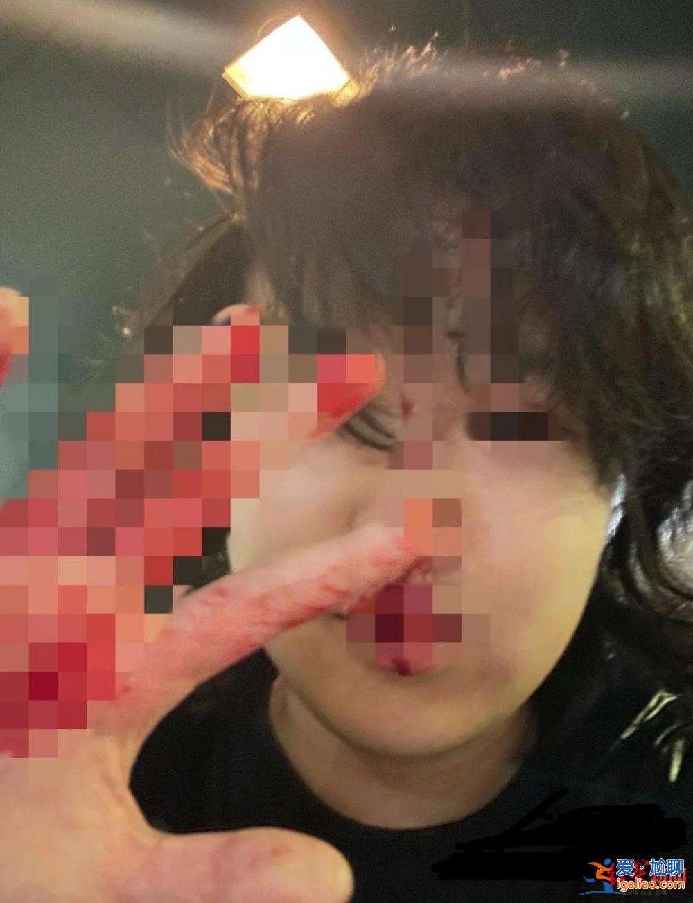 警察說是彈珠槍 能活著真好？