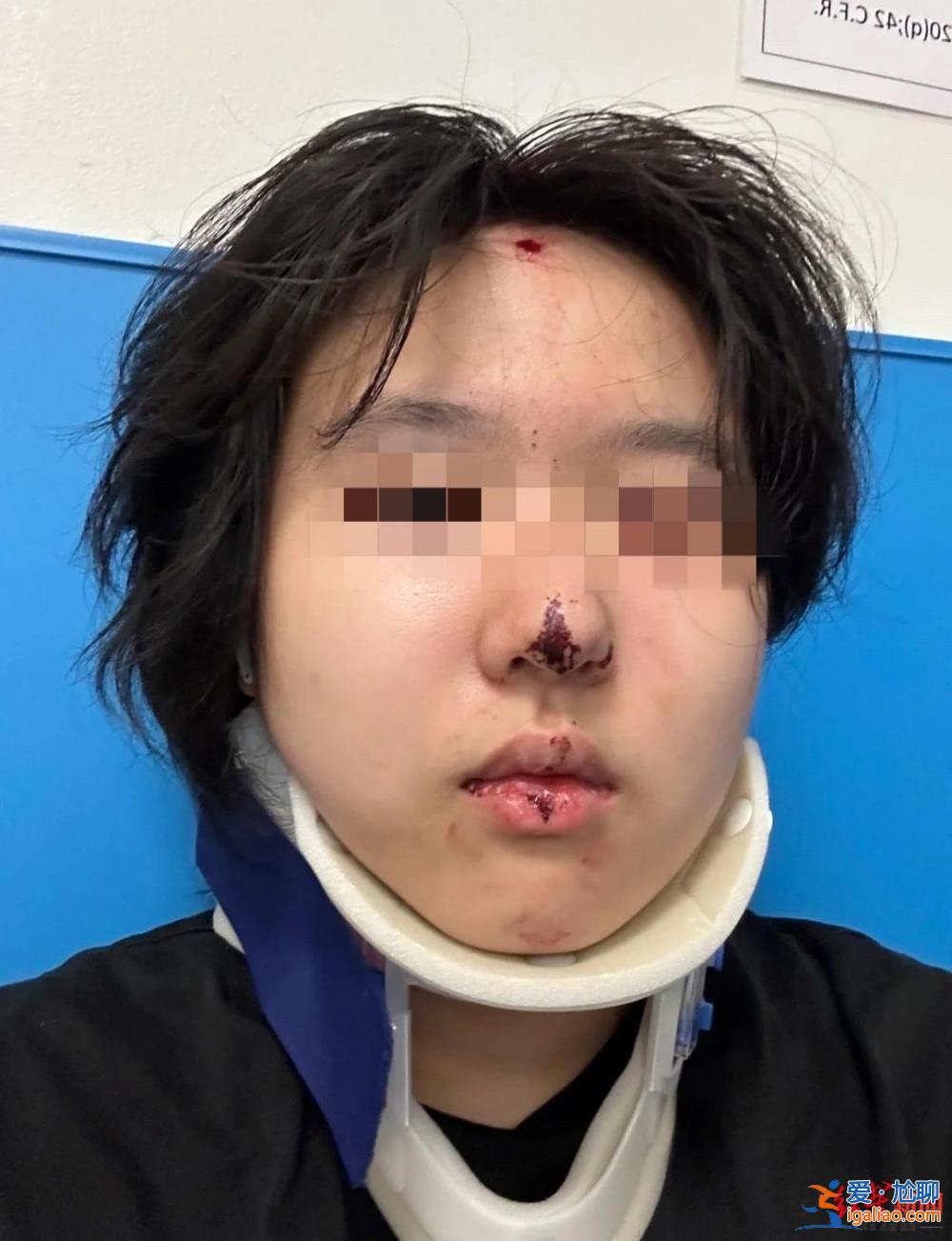 警察說是彈珠槍 能活著真好？