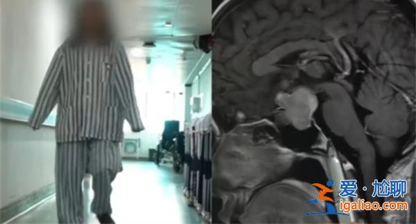 女生每月3次月經(jīng)腦部查出垂體瘤，垂體瘤有何癥狀[腦垂體]？
