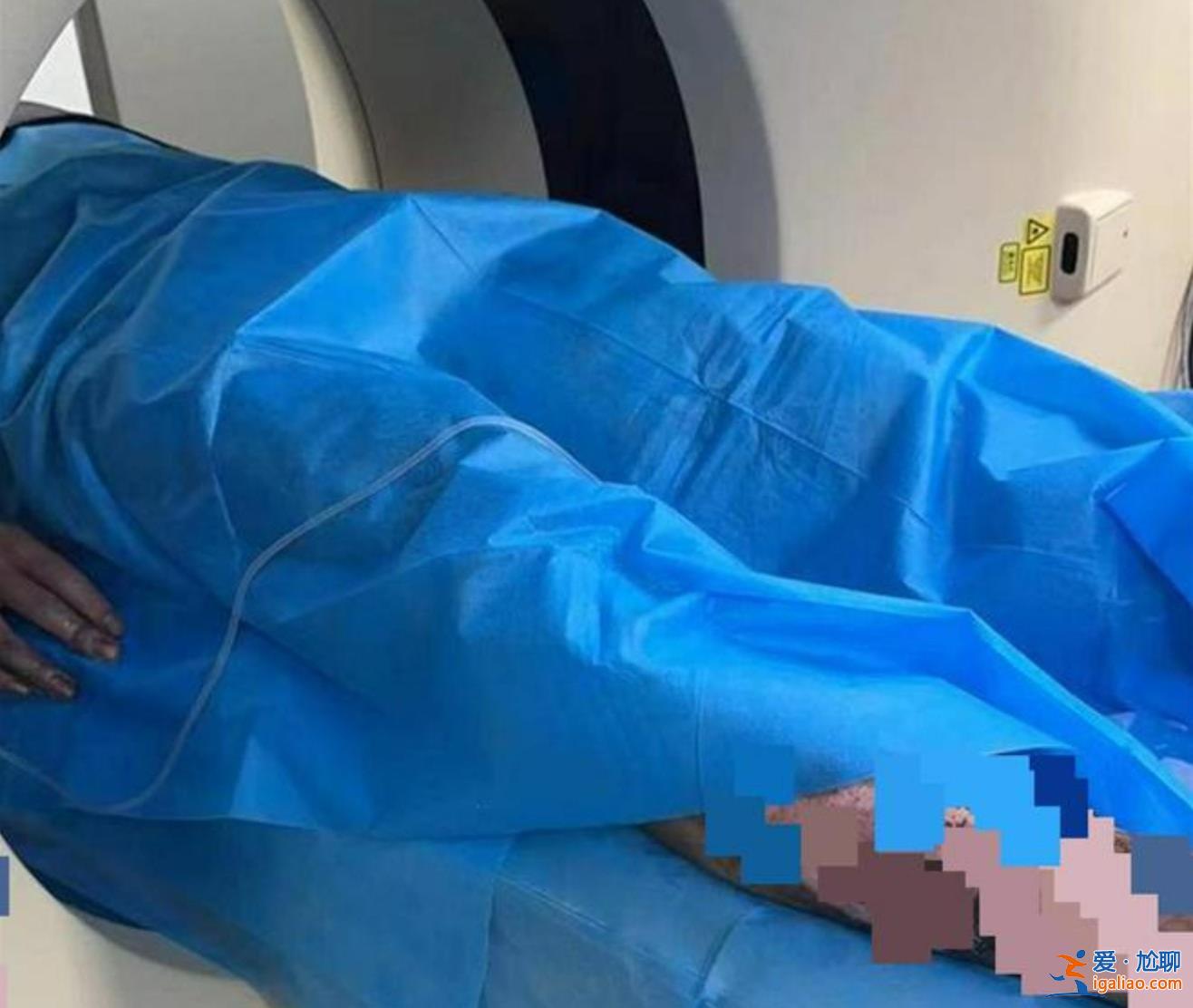 大學(xué)生爬火車拍照被燒傷進(jìn)ICU 燒傷后皮膚能恢復(fù)如初嗎？
