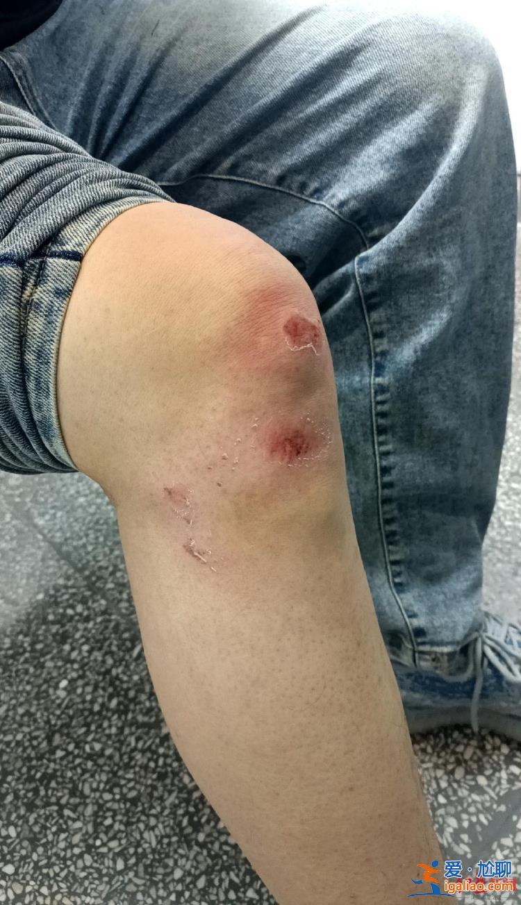 案件已受理 正在處理中？