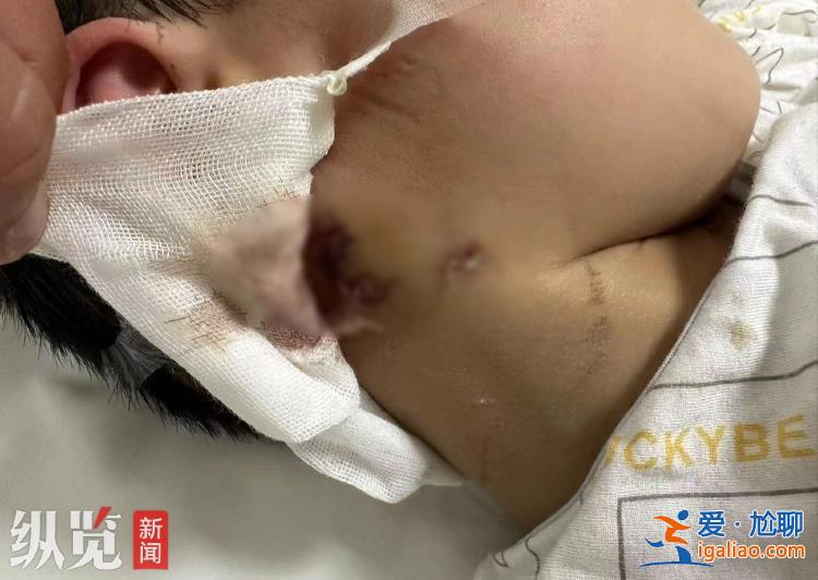 只希望盡快找到狗主人？