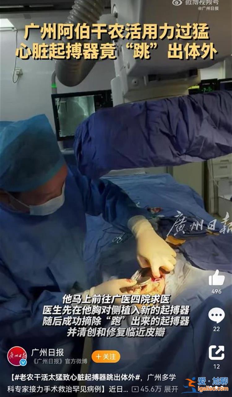 68歲老人干活太用力致心臟起搏器跳出體外 多名專家接力手術(shù)成功救治？
